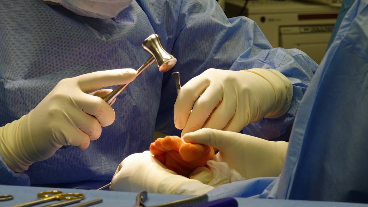 gallery-4 Detailed image of a surgical team performing a foot procedure in a sterile environment.